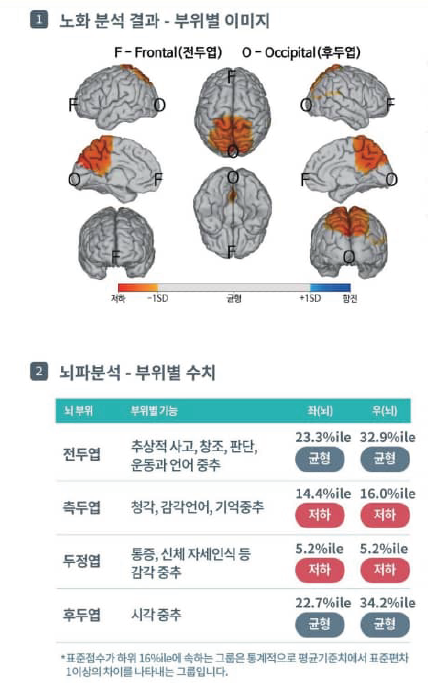iSync Brain (뇌파측정 결과를 알기 쉽게 도식화 하여 보여주는 Ai 기반 소프트웨어)